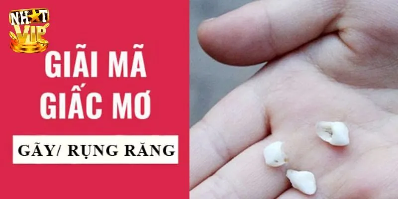 Mơ Thấy Răng Rụng Điềm Gì? Thông Tin Hữu Ích Cho Các Bạn Mơ Thấy Răng Rụng Điềm Gì? Thông Tin Hữu Ích Cho Các Bạn
